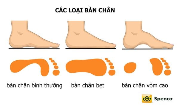 Bí kíp chọn giày cao gót phù hợp theo kiểu chân